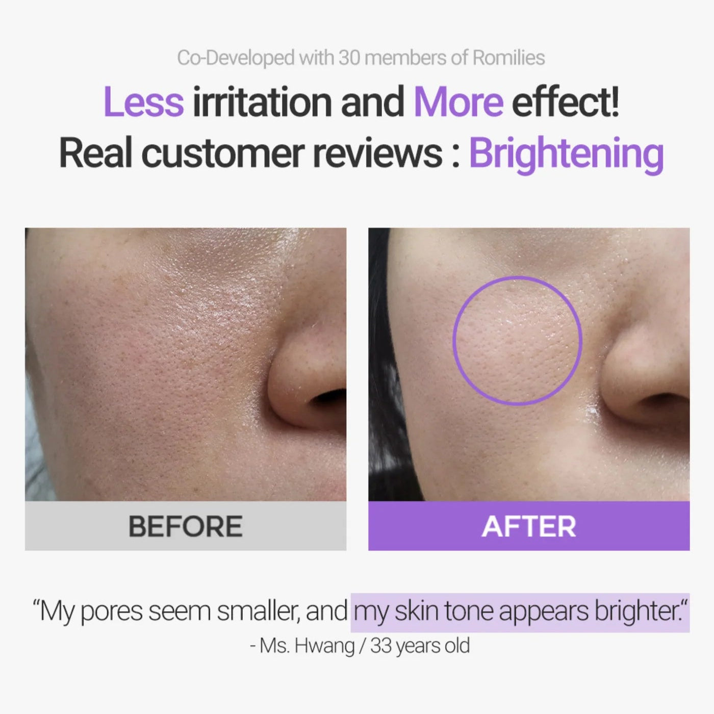 Retinosine Deep Intense Cream