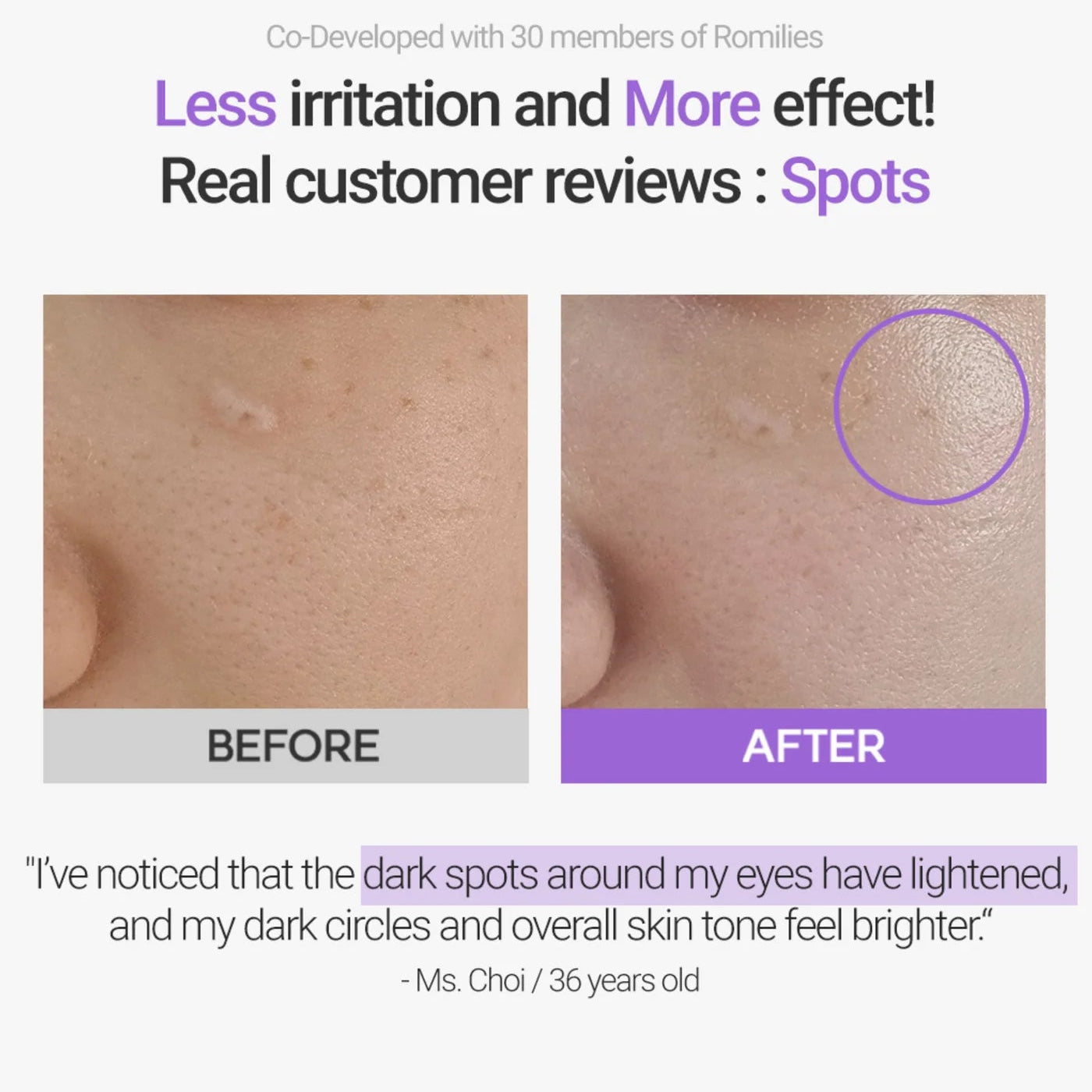 Retinosine Deep Intense Cream
