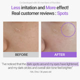 Retinosine Deep Intense Cream