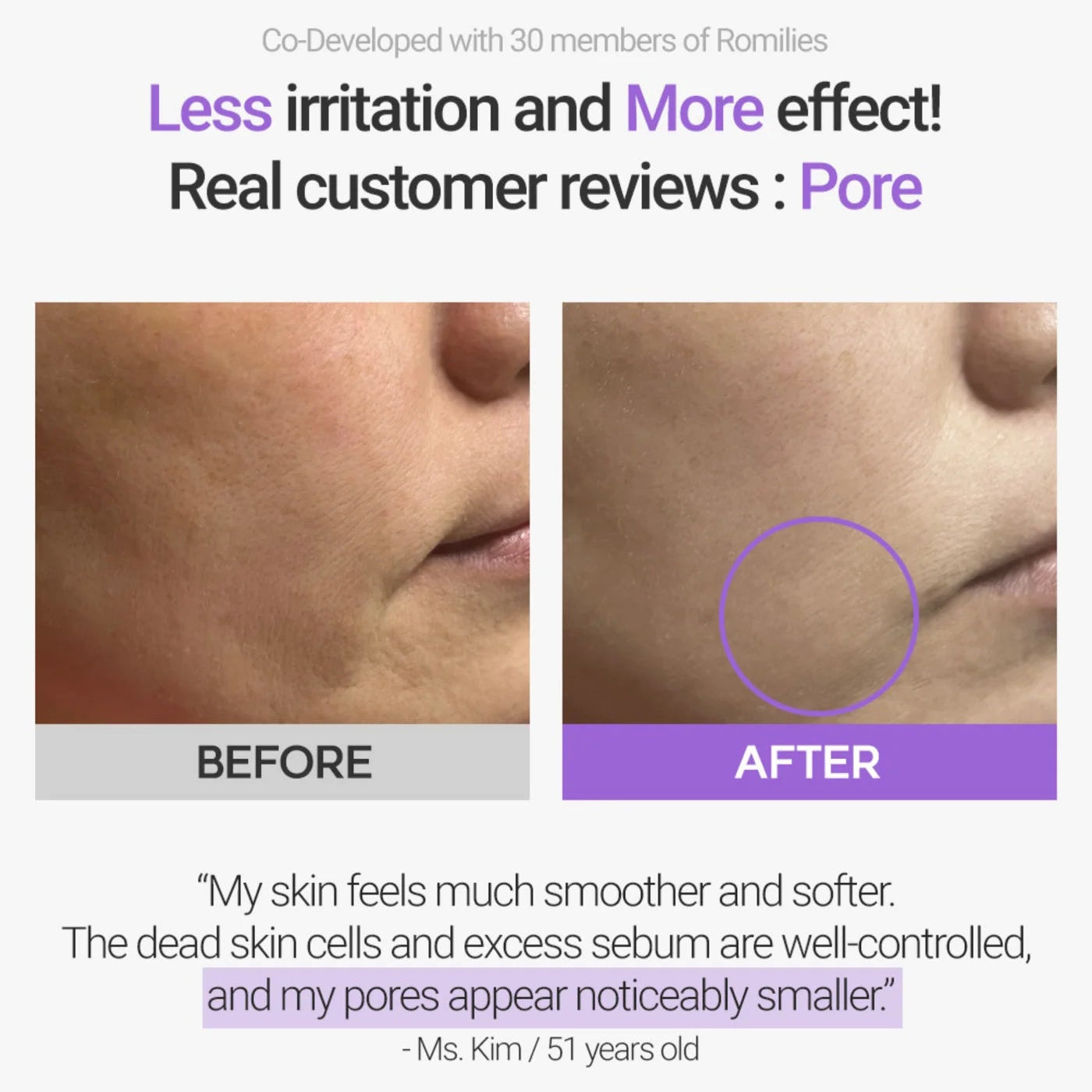 Retinosine Deep Intense Cream