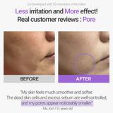 Retinosine Deep Intense Cream
