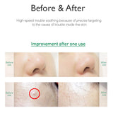 Trouble Care Microcone Patch