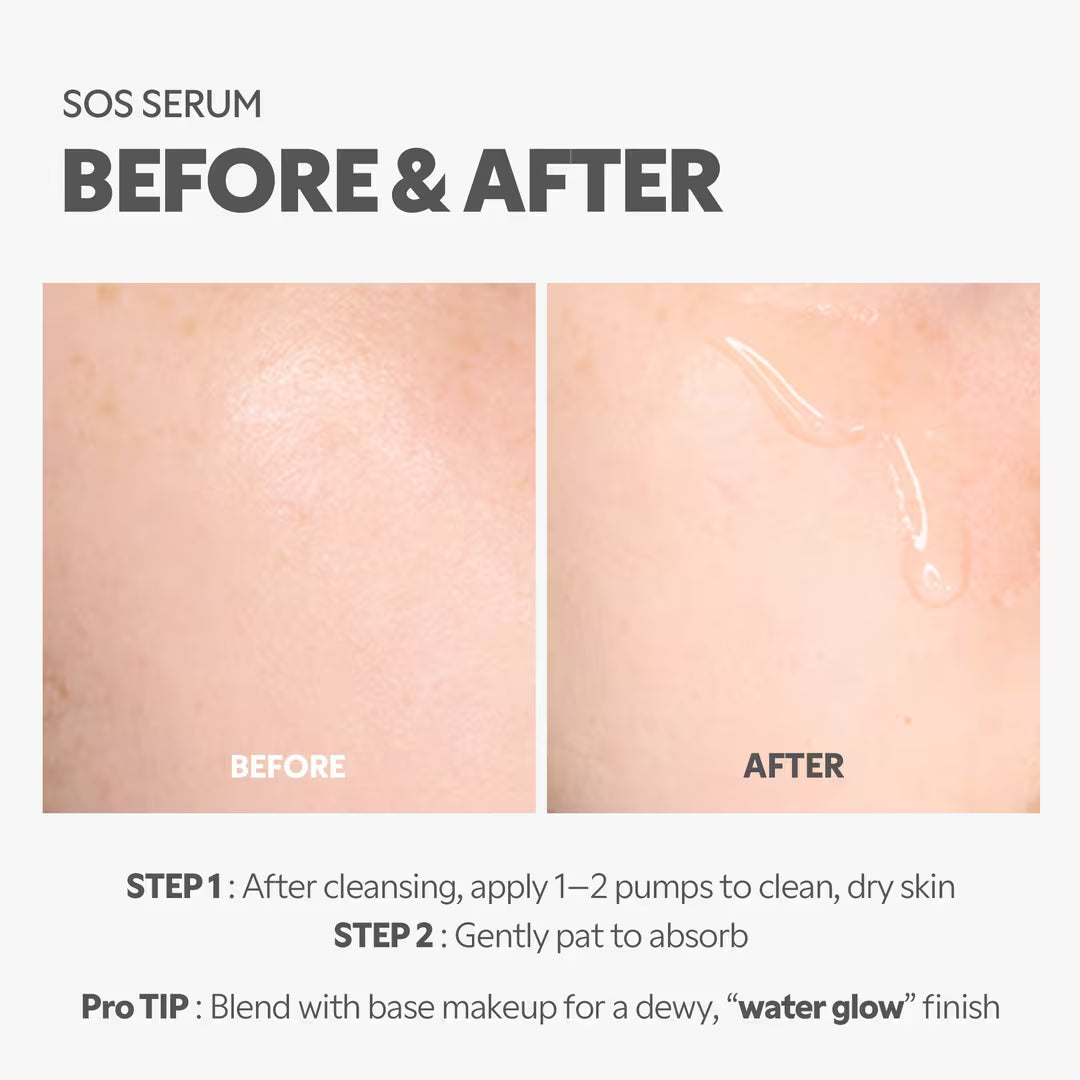 SOS Serum