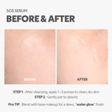 SOS Serum