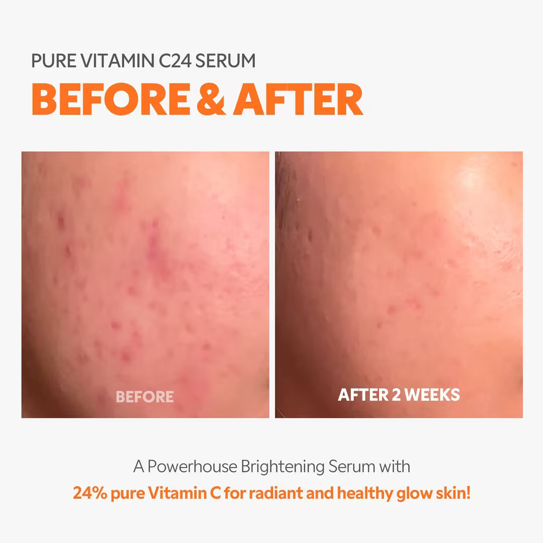 Pure Vitamin C24 Serum