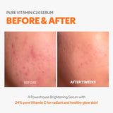 Pure Vitamin C24 Serum
