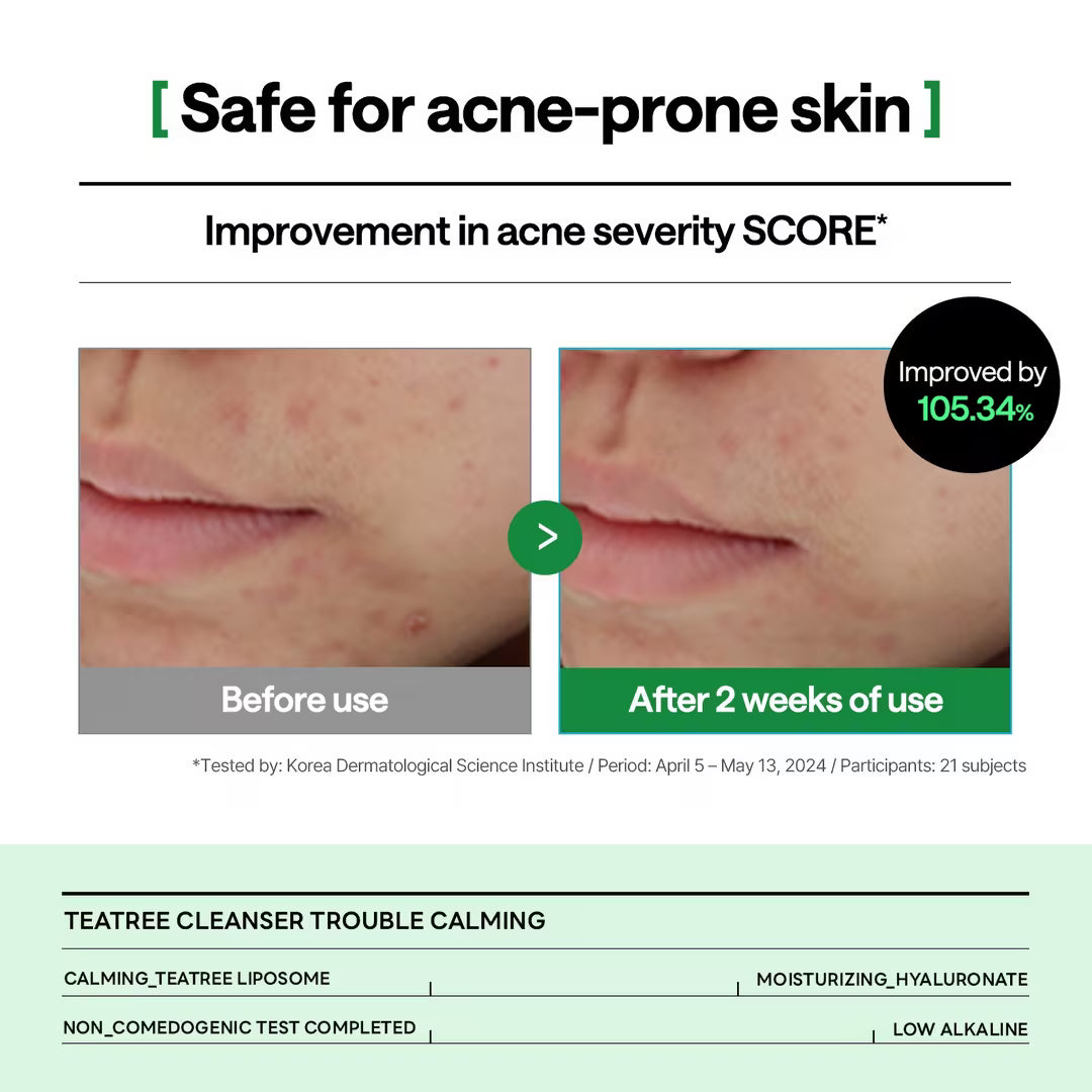 Teatree Cleanser Trouble Calming