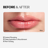 Reedle Shot Lip Plumper Beginner