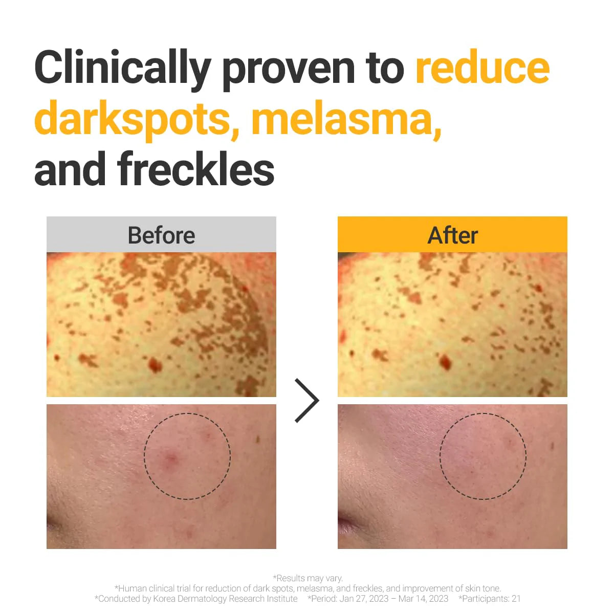 Vita Dark Spot Serum