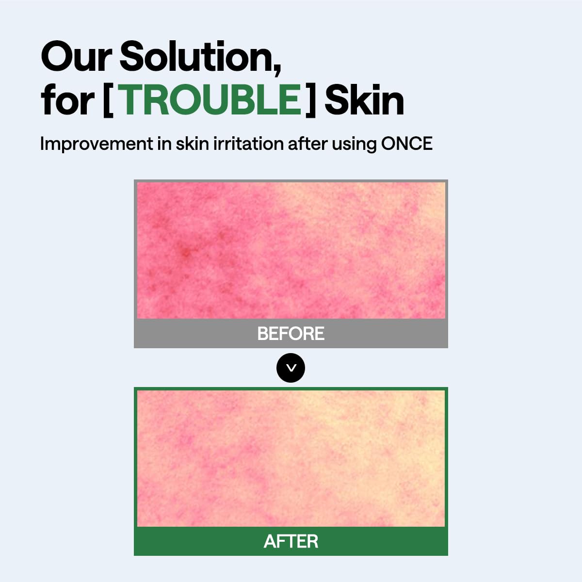 Teatree Wrapping Serum Mask Calming Hydra