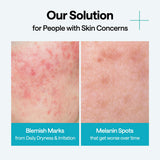 Madecassoside Wrapping Serum Mask Blemish Repair
