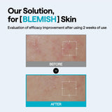 Madecassoside Wrapping Serum Mask Blemish Repair