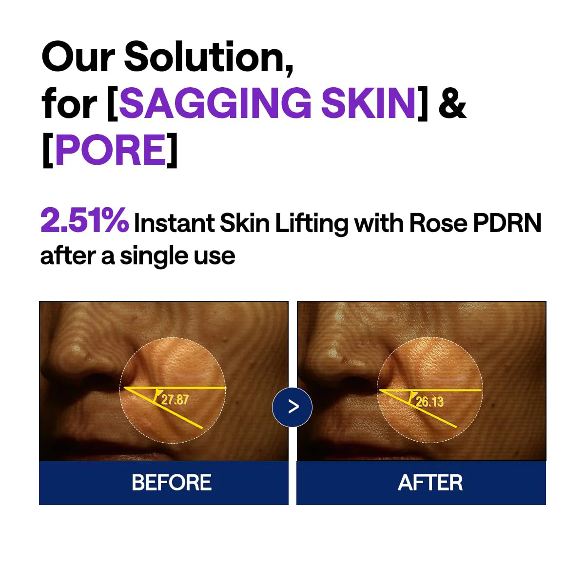 PDRN Lifting Serum