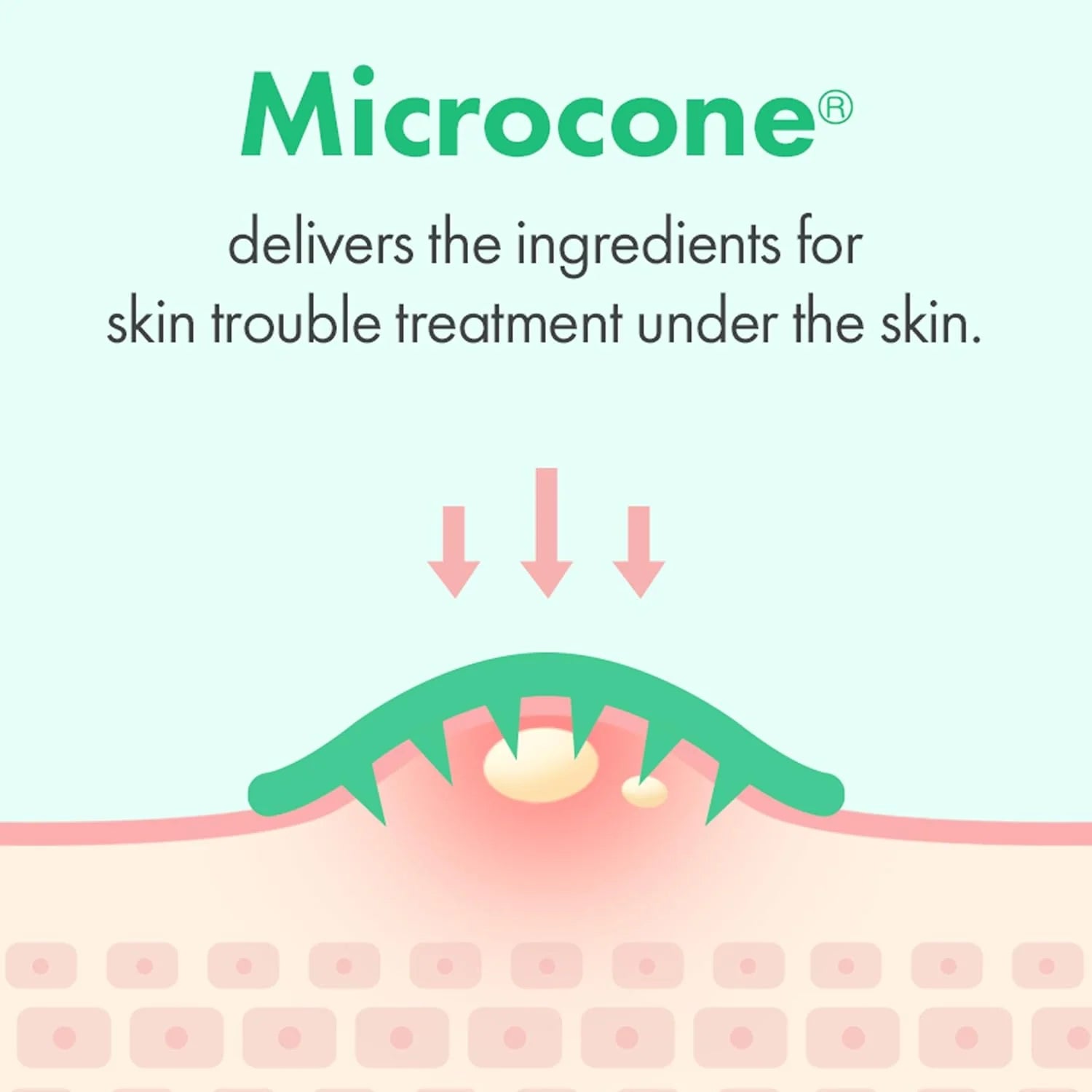 Trouble Care Microcone Patch