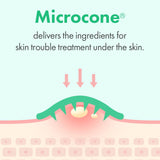 Trouble Care Microcone Patch