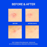 RIGHT AWAY Thincognito Spot Patch