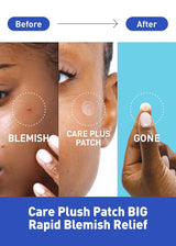 Care Plus Spot Cover Patch Calming