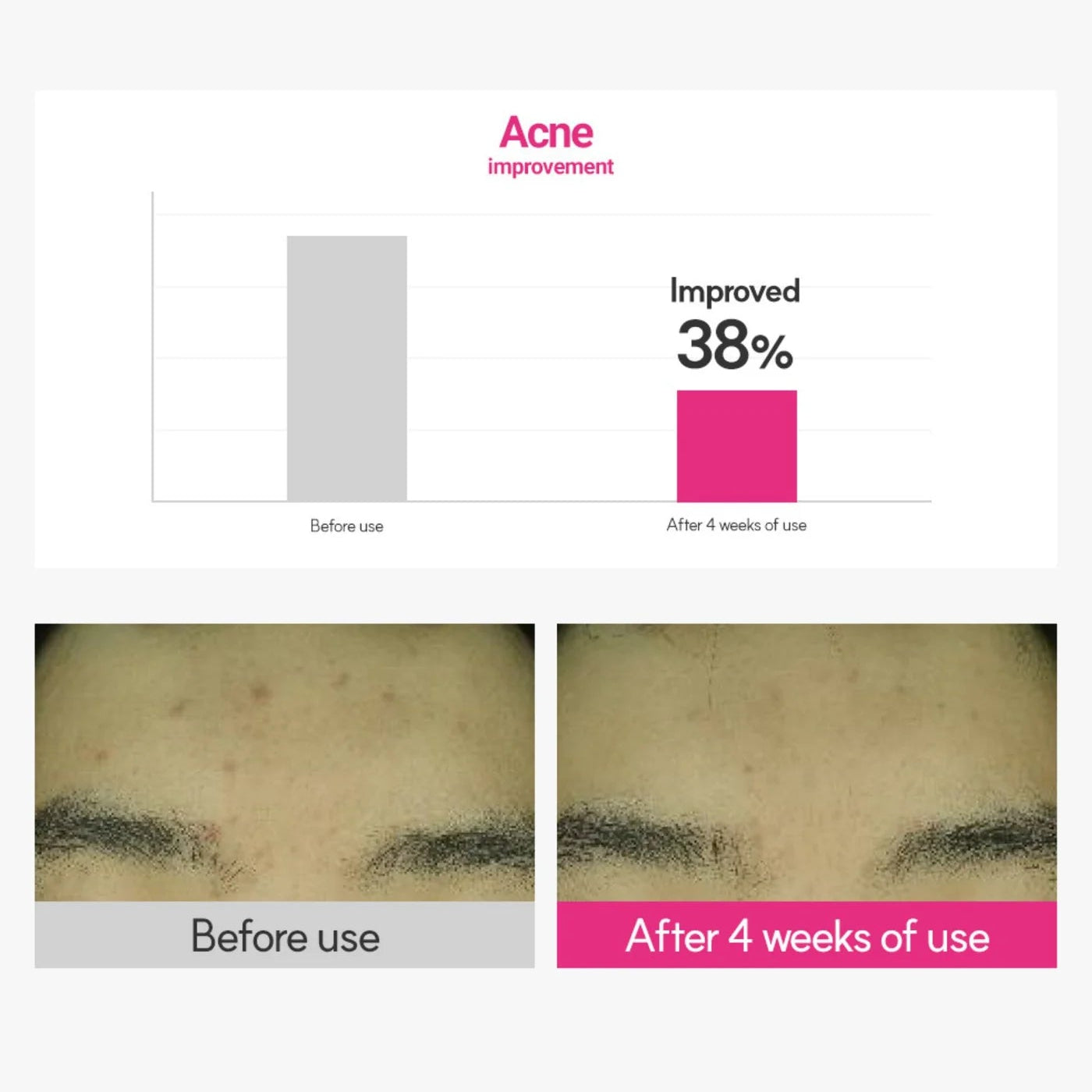 Cica Care Blemish Clearing Cream