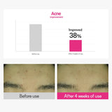 Cica Care Blemish Clearing Cream