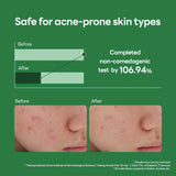 Teatree Calming Hydra Serum