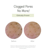 Deep Pore Cleansing Soda Foam